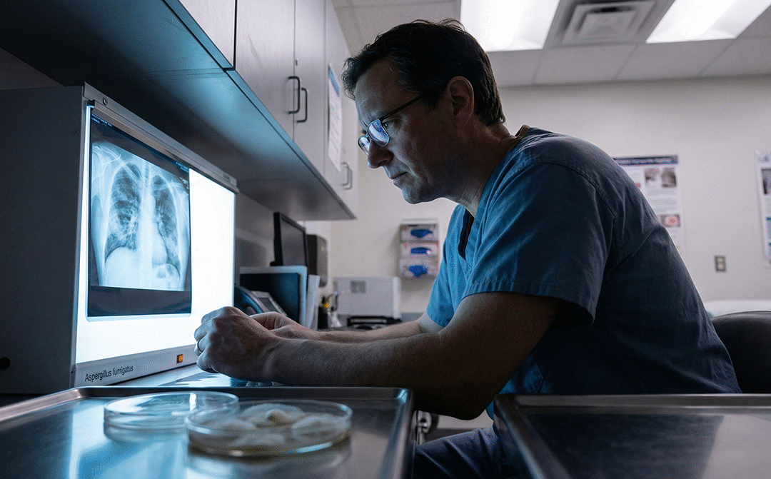 Fungal Horror in the Brain: The Coccidioidomycosis Infection That Exposed a Hidden Immune Crisis