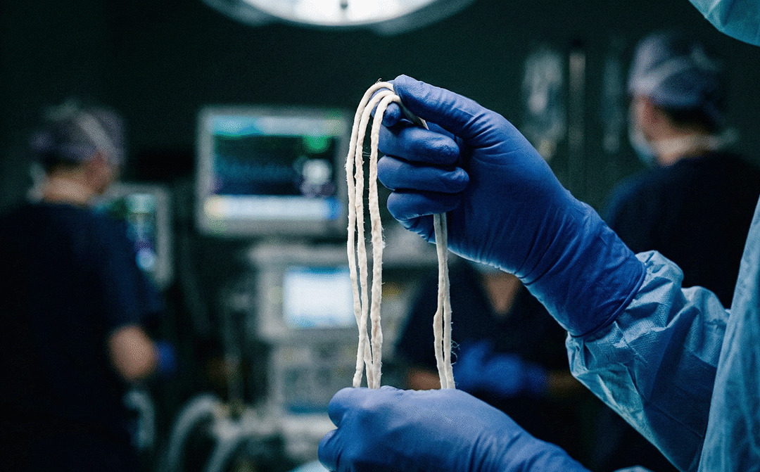 White Clots, Bleak Outcomes: From Unexplained Embalmer Observations to a G6PD Hypothesis