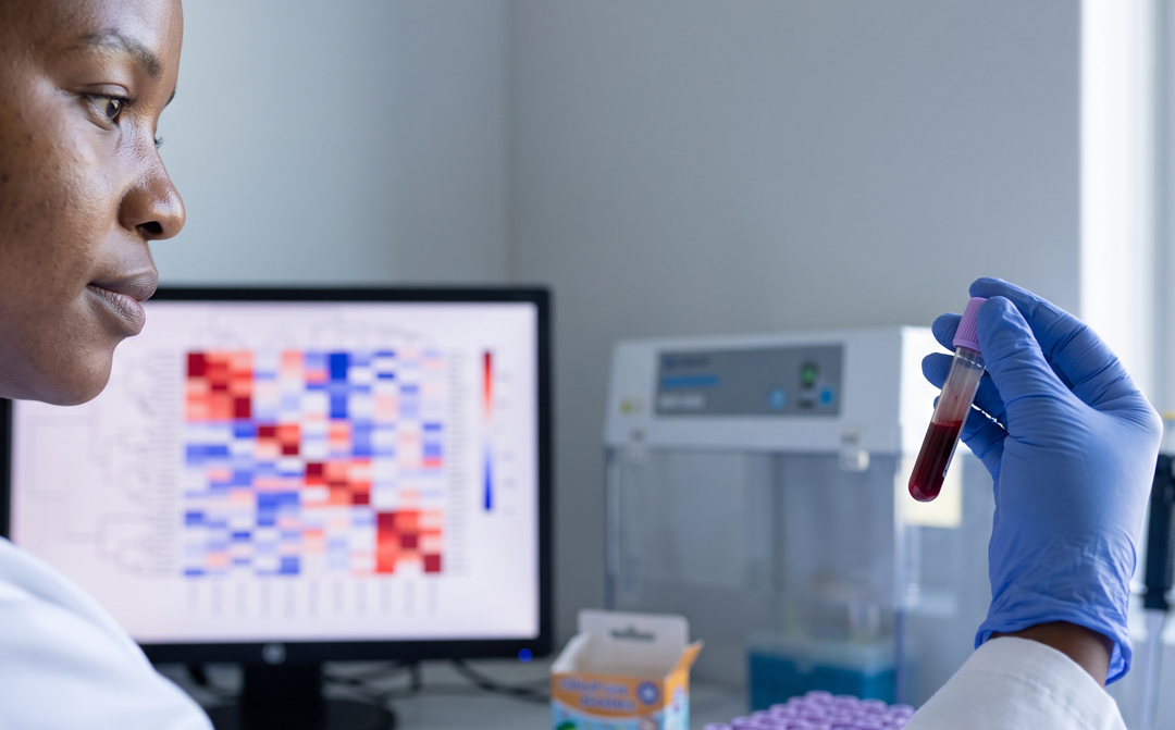 Blood gene activity may help explain why some children become seriously ill with COVID-19